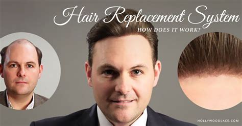 Men's Hair Systems: The Solution to Your Hair Loss Woes