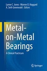 Metal-on-Metal Bearings A Clinical Practicum Kindle Editon