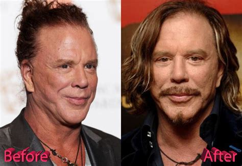 Mickey Rourke: Before and After: A Journey of Redemption and Transformation