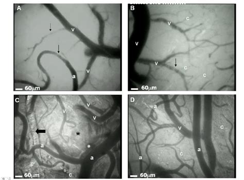 Microcirculation Imaging Reader