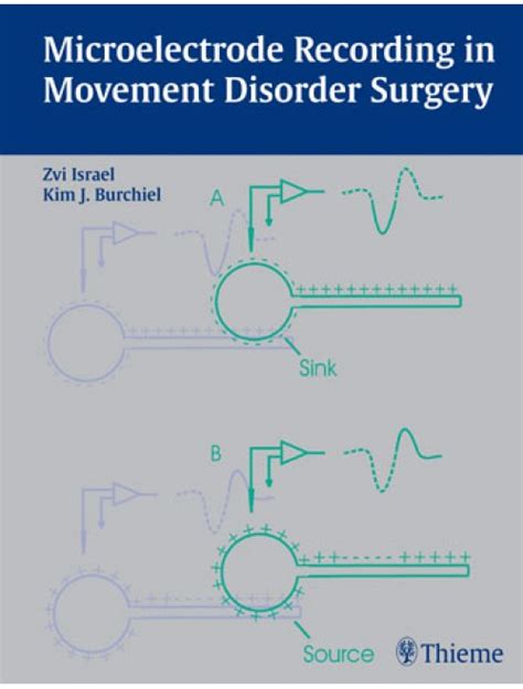 Microelectrode Recording in Movement Disorder Surgery Kindle Editon