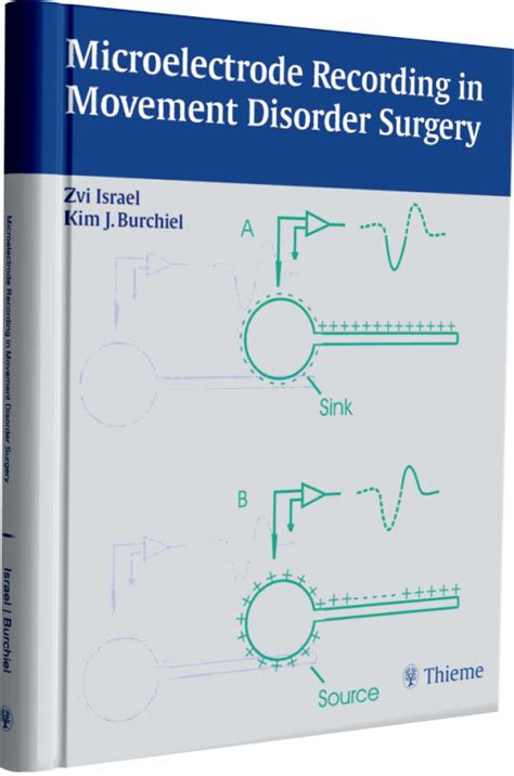 Microelectrode Recording in Movement Disorder Surgery Kindle Editon