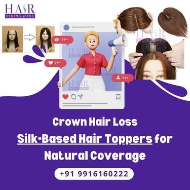 Milano Hair Topper: A Solution for Hair Loss Concerns