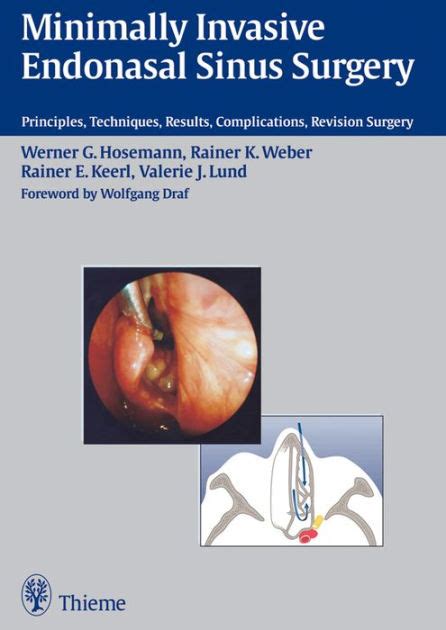 Minimally Invasive Endonasal Sinus Surgery Principles Epub