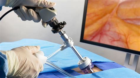 Minimally Invasive Surgical Devices: