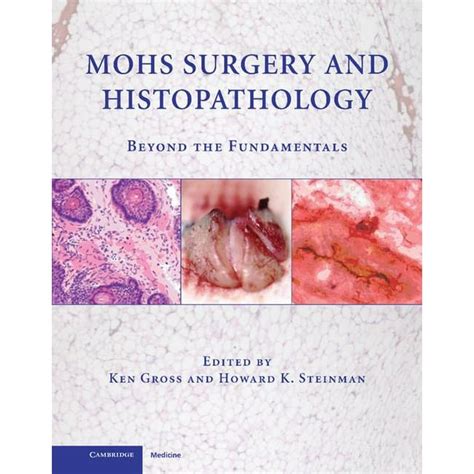 Mohs Surgery and Histopathology Beyond the Fundamentals Doc