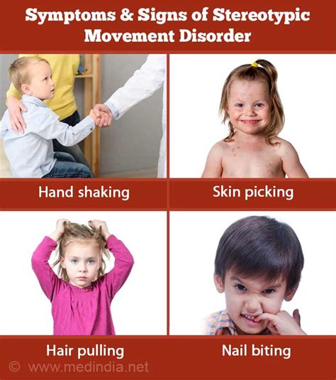 Movement Disorders PDF