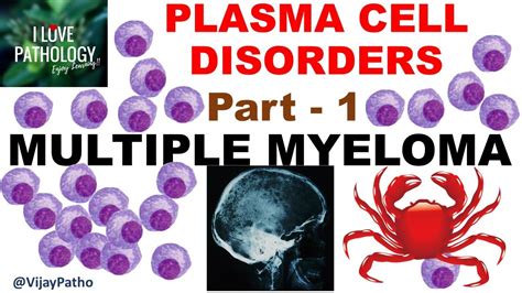 Multiple Myeloma and Related Plasma Cell Disorders 1st Edition Kindle Editon