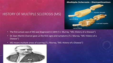 Multiple Sclerosis: The History of a Disease Kindle Editon