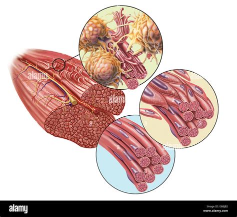 Muscle damage: