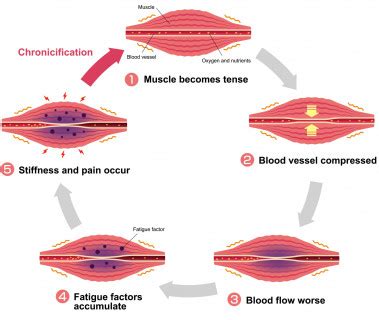 Muscle fatigue: