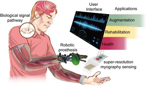 Musclebem: The Evolving Field of Muscle-Based Electronics