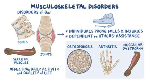 Musculoskeletal disorders: