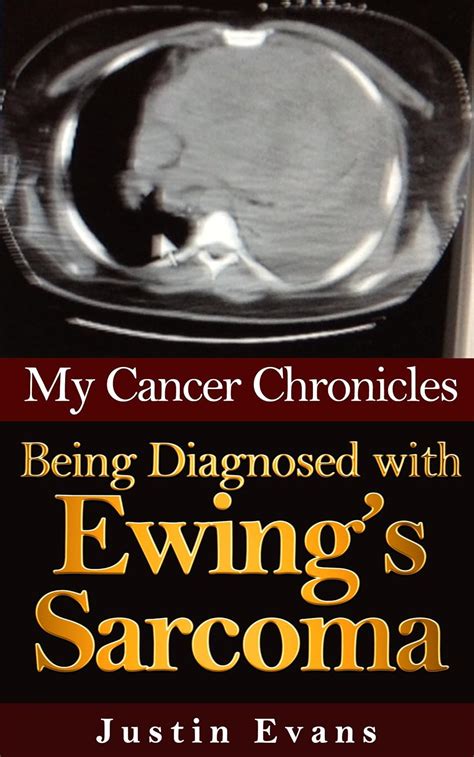 My Cancer Chronicles Being Diagnosed with Ewing s Sarcoma Volume 1 PDF