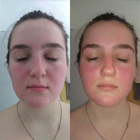 My Face Turns Red in the Sun: 72,000,000,000 Causes and Solutions