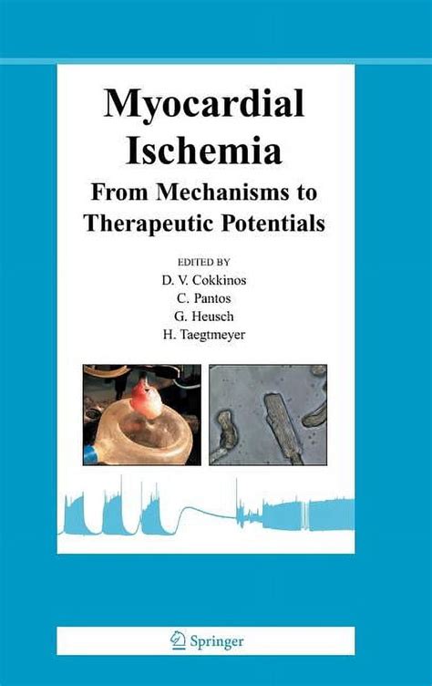 Myocardial Ischemia From Mechanisms to Therapeutic Potentials 1st Edition Doc