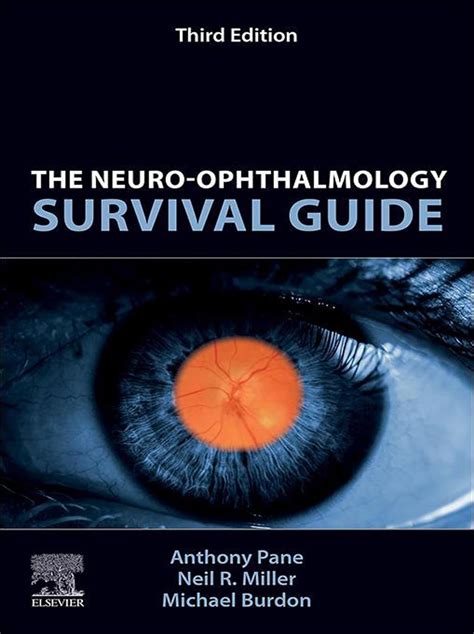 NEURO OPHTHALMOLOGY SURVIVAL GUIDE Ebook PDF