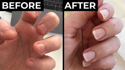 Nail Polish for Nail Biters: A Comprehensive Guide to Breaking the Habit