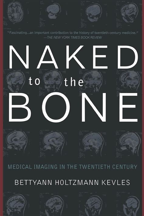 Naked to the Bone Medical Imaging in the Twentieth Century Kindle Editon