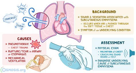 Nasal Crepitation