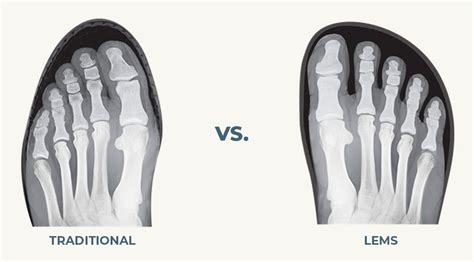 Natural FootShape Toe Box: