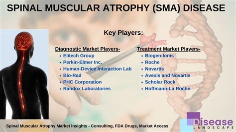 Navigating Spinal Muscular Atrophy in Singapore: A Comprehensive Guide