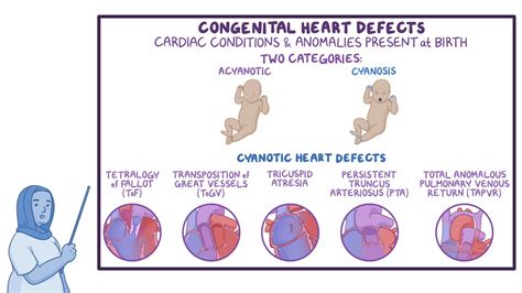 Neonatal Heart Disease A New Pathogen Epub