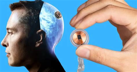 Neuralink Implant: