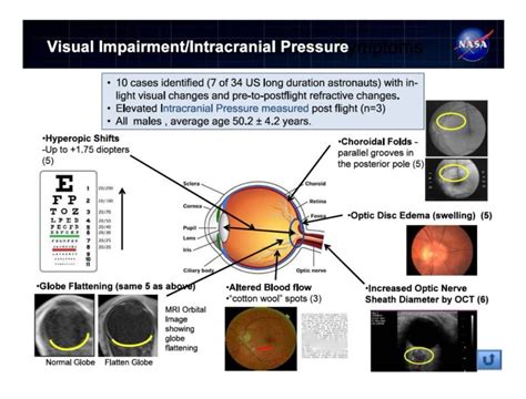 Neuro-Ocular Optimization