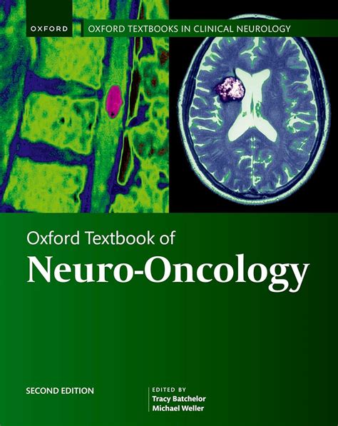 Neuro-Oncology 2nd Edition Epub