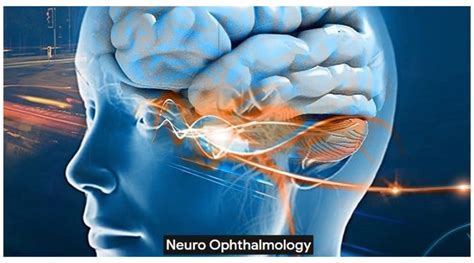 Neuro-Ophthalmology Doc