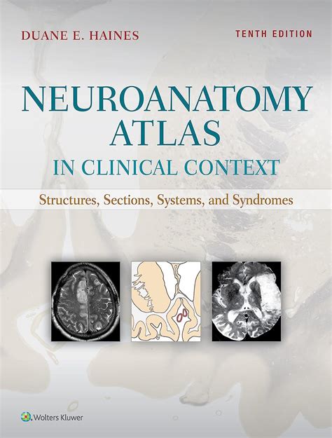 Neuroanatomy An Atlas of Structures, Sections, and Systems 5th Edition Reader