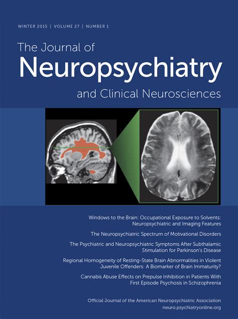 Neurobiological and Clinical Consequences of Stress From Normal Adaptation to Post-traumatic Stress Kindle Editon