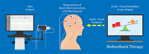 Neurofeedback training: