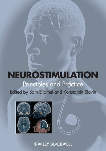 Neurostimulation Principles and Practice Epub