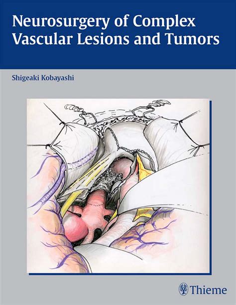 Neurosurgery of Complex Vascular Lesions and Tumors Epub