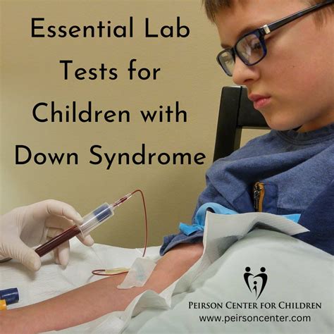 New Approaches to Down Syndrome Doc