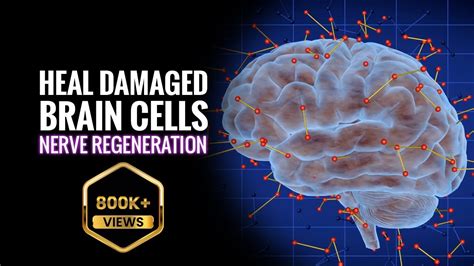 New Perspectives on Brain Cell Damage Epub