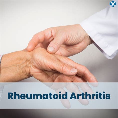 New Treatment in Arthritis PDF