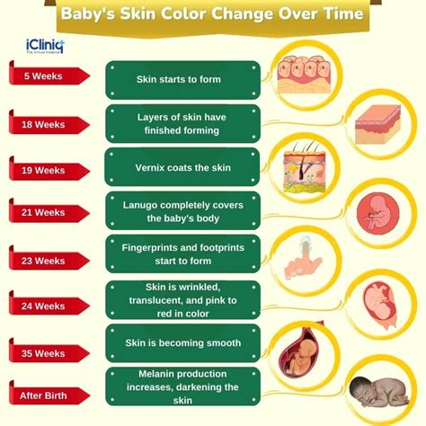 Newborn Baby Skin Color Chart