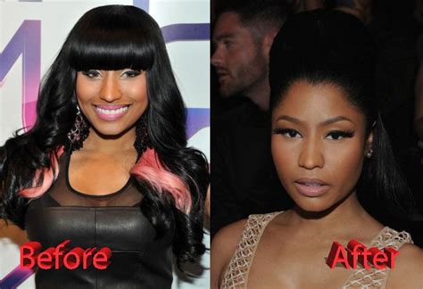 Nicki Minaj: A Journey of Transformation from Before to After