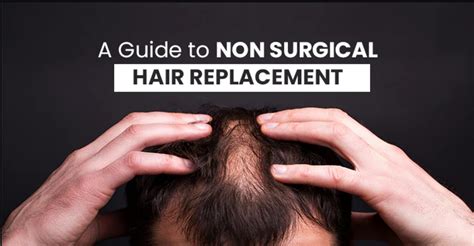 Non-Surgical Hair Replacement: 2023 Guide to Regaining Your Crowning Glory