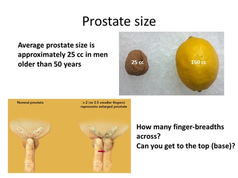 Normal Prostate Size: Everything You Need to Know