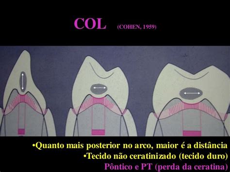 O Que é Col?