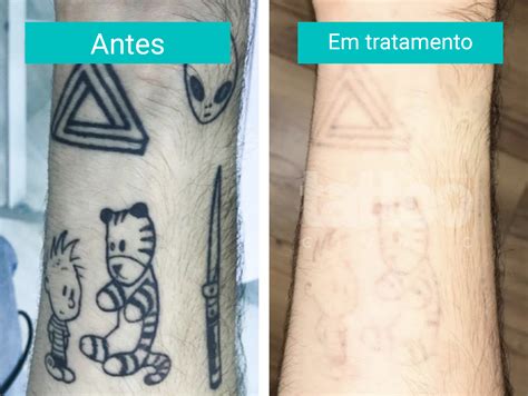 O Que é uma Tatuagem de Transferência?