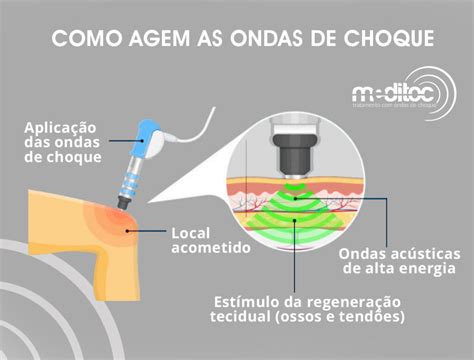 O Que Acontece Durante o Tratamento de Choque?