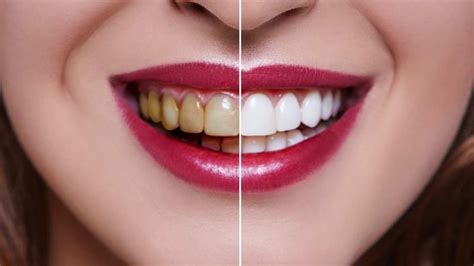 O Significado de Sonhar com Dentes: Um Guia Completo