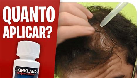 O que é Minoxidil?