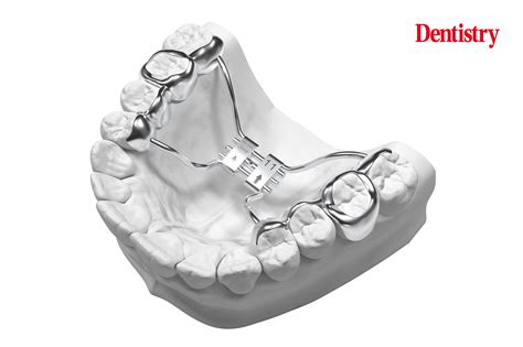 Oakeson Steiner: Transforming Orthodontics with Innovative Appliances