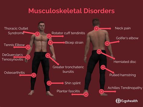 Occupational Musculoskeletal Disorders Epub